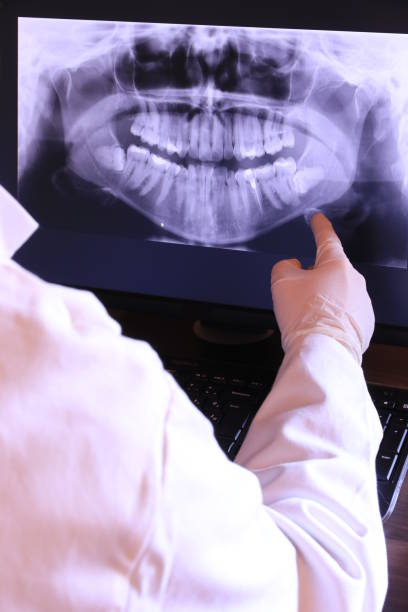 Best Broken or Chipped Tooth Repair in Kellogg, ID