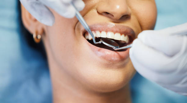 Best Emergency Wisdom Tooth Extraction in Kellogg, ID